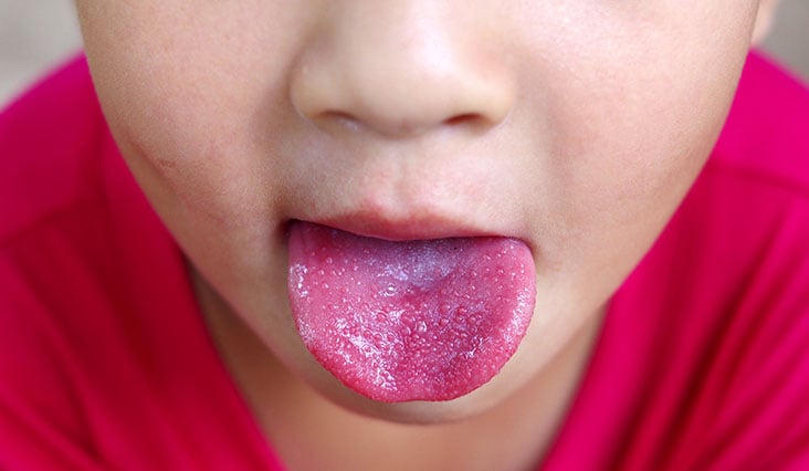 Vyrážky signalizujú chorobu: Spoznajte príznaky včas!