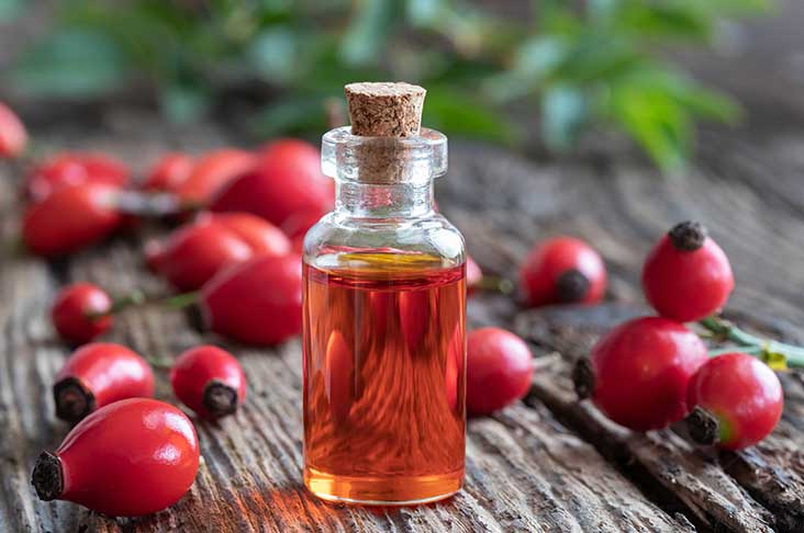 November: jarabina, šípky či zazimovanie záhrady