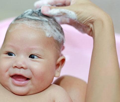 Így ápolja a babák korpás fejbőrét