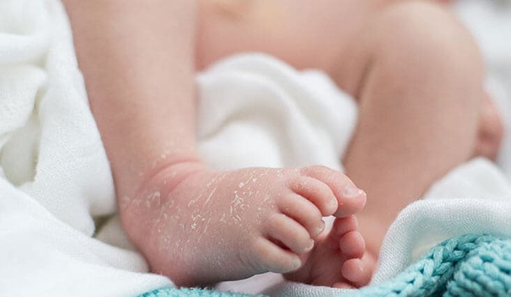 Így óvhatja kisbabája bőrét