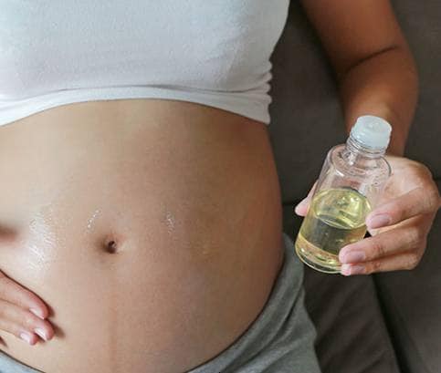Tippek a terhességi csíkok ellen