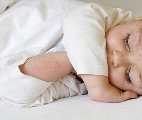 Spála, pátá nemoc a další nepříjemnosti, které u dětí poznáte podle vyrážky