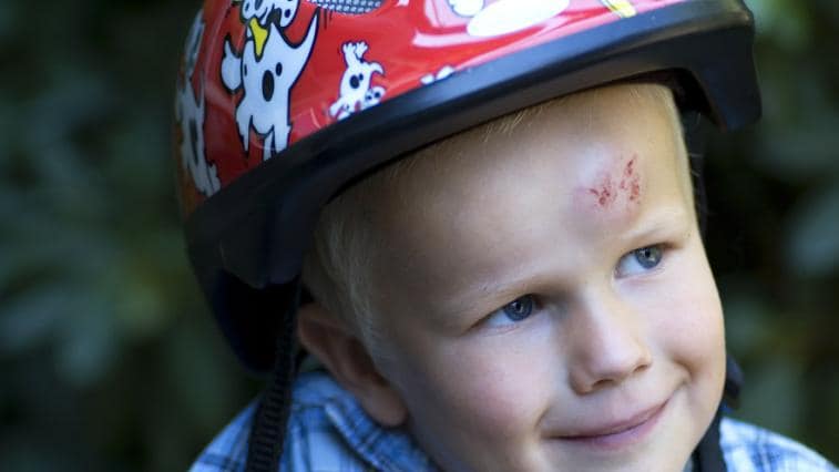 Poznáte otřes mozku nebo zlomeninu lebky u dětí?