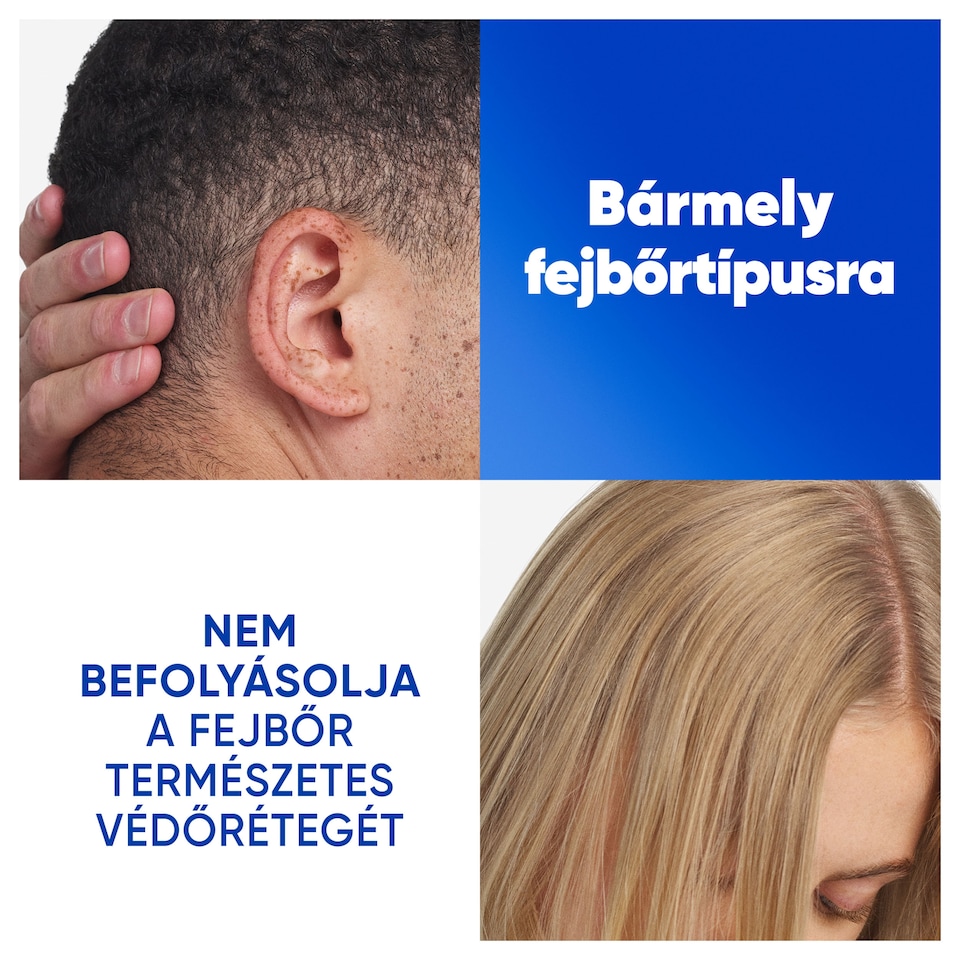 Head & Shoulders Citrus Fresh korpásodás elleni sampon zsíros hajra 500ml napi használatra 1. kép