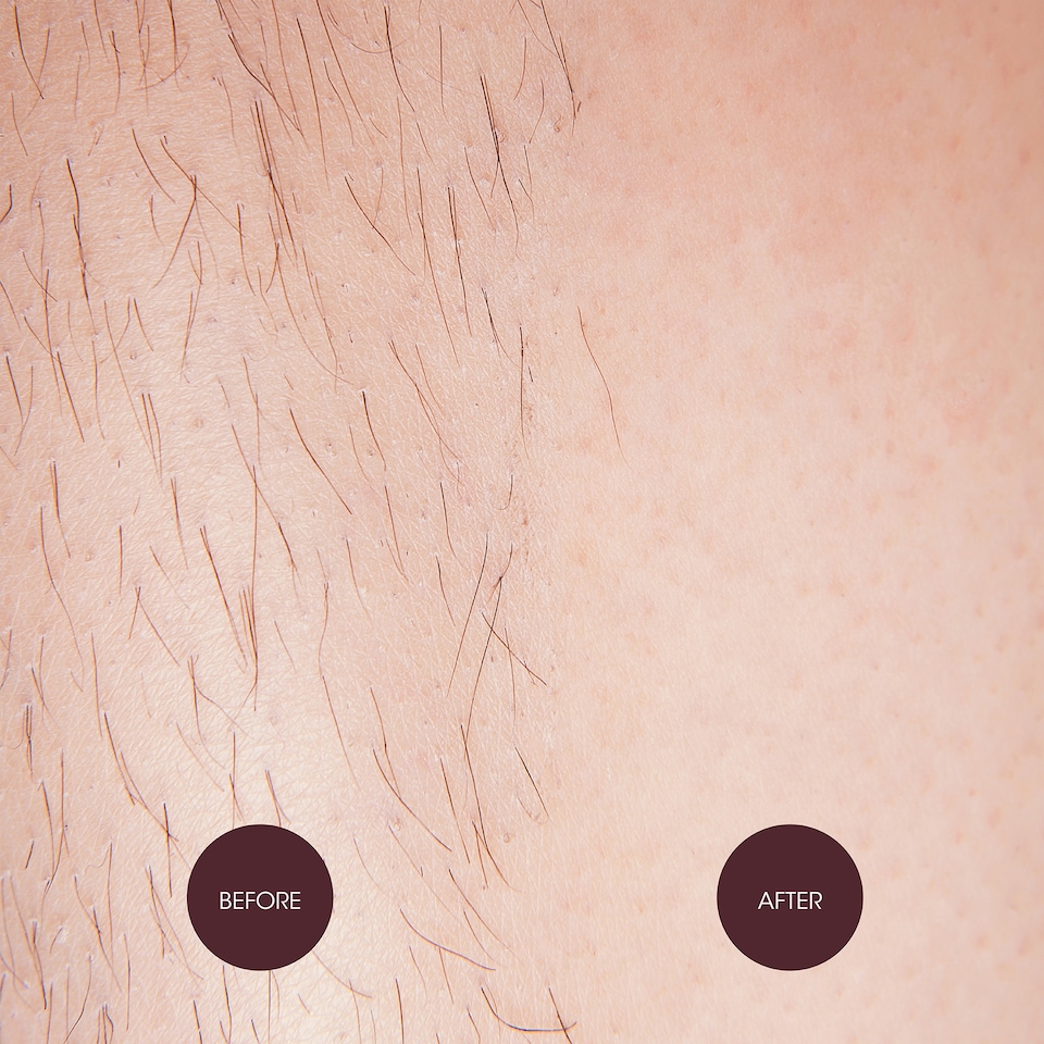 image 1 of Nad's Strawberries & Cream Waxing Dots 200g