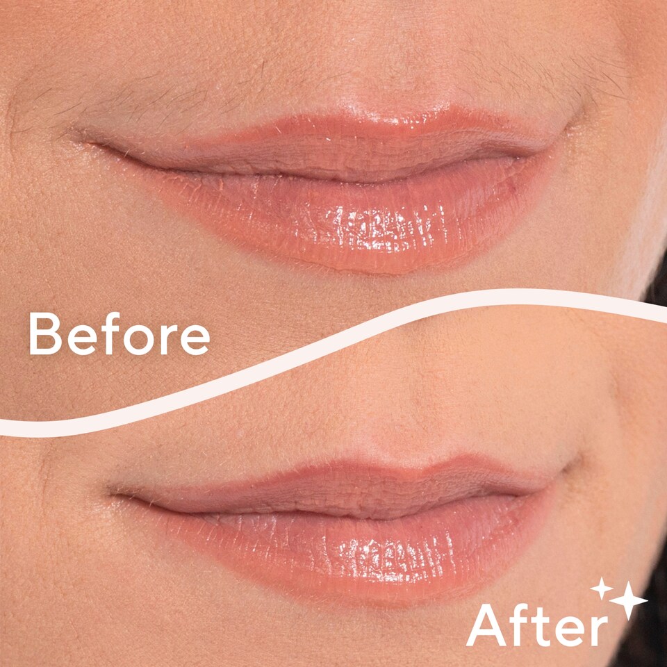 image 1 of Flawless Facial Hair Remover