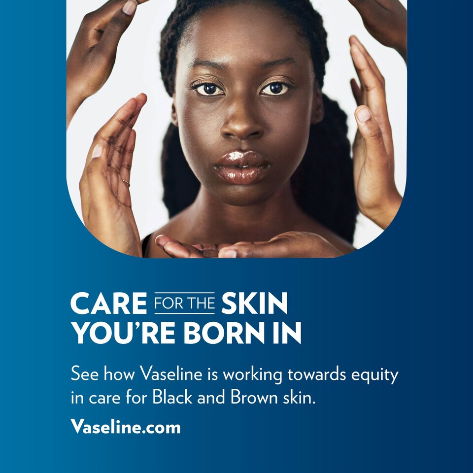 image 1 of Vaseline Lip Tin Rosy Butter 20g