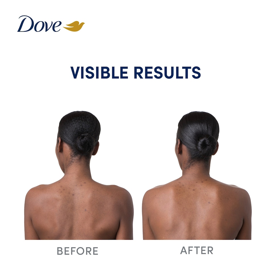 image 1 of Dove Niacinimide+ Even Tone Body Serum 200ml