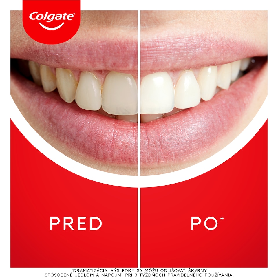 obrázok 1 z Colgate Max White Ultra Freshness Pearls bieliaca zubná pasta 50ml