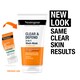 image 5 of Neutrogena Visibly Clear 2 In 1 Mask 150Ml