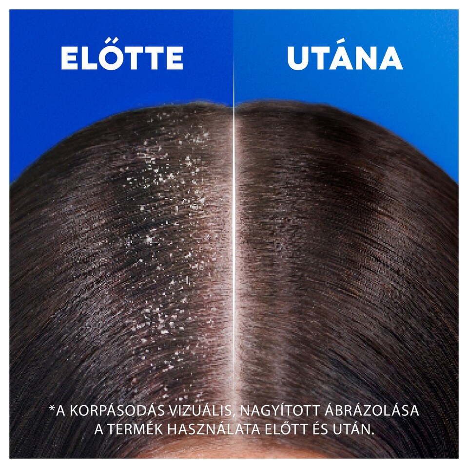 Head & Shoulders Apple Fresh korpa elleni sampon 250ml napi használatra bármely hajtípusra  1. kép