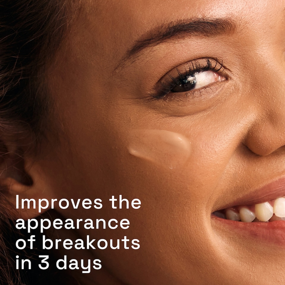 image 1 of Cetaphil Gentle Clear Triple Action Blemish Serum 30ml