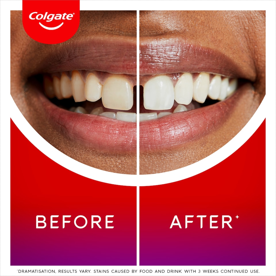 image 1 of Colgate Max White Ultimate Renewal Whitening Toothpaste 75ml