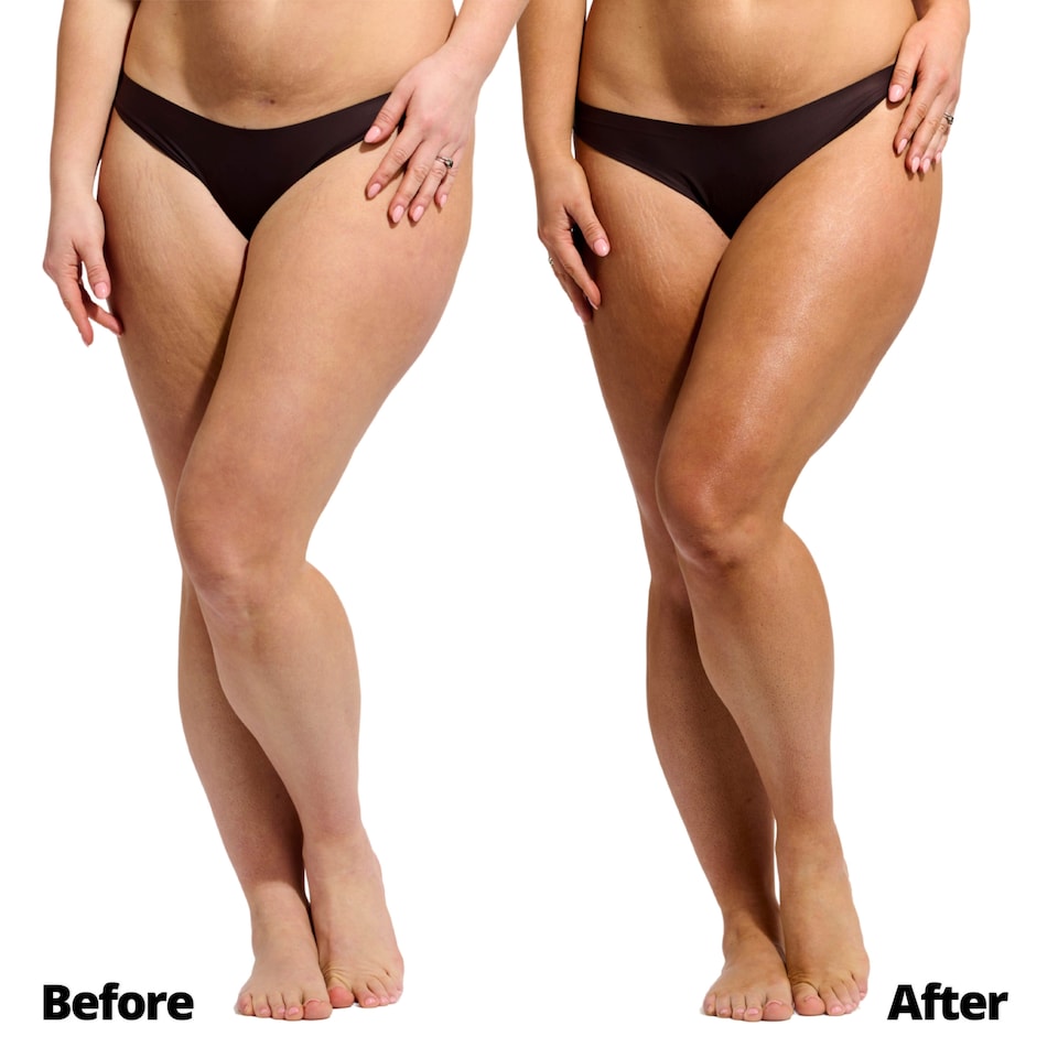 image 1 of Skinny Tan Self Mousse 150Ml