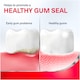 image 5 of Corsodyl Complete Protection Gum Care Mouthwash Extra Fresh 500 ml