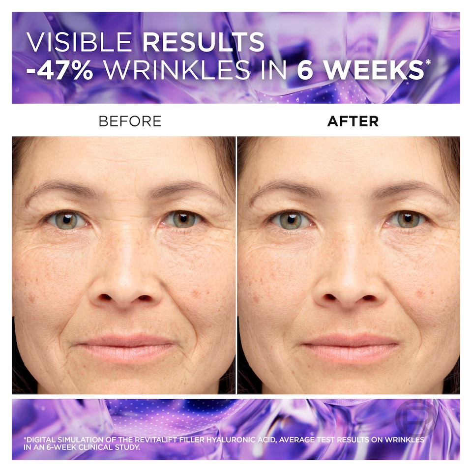 image 1 of L'Oreal Paris Revitalift Filler Anti Wrinkle Serum 30Ml