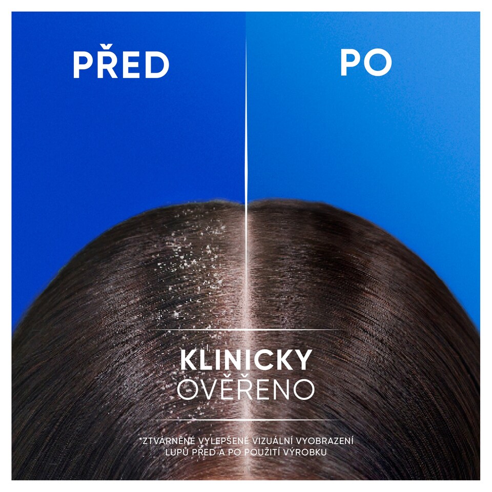 Obrázek 1 pro produkt Head & Shoulders Menthol Fresh 2in1 Šampon proti Lupům 330 ml. Osvěžující Mentolová Vůně