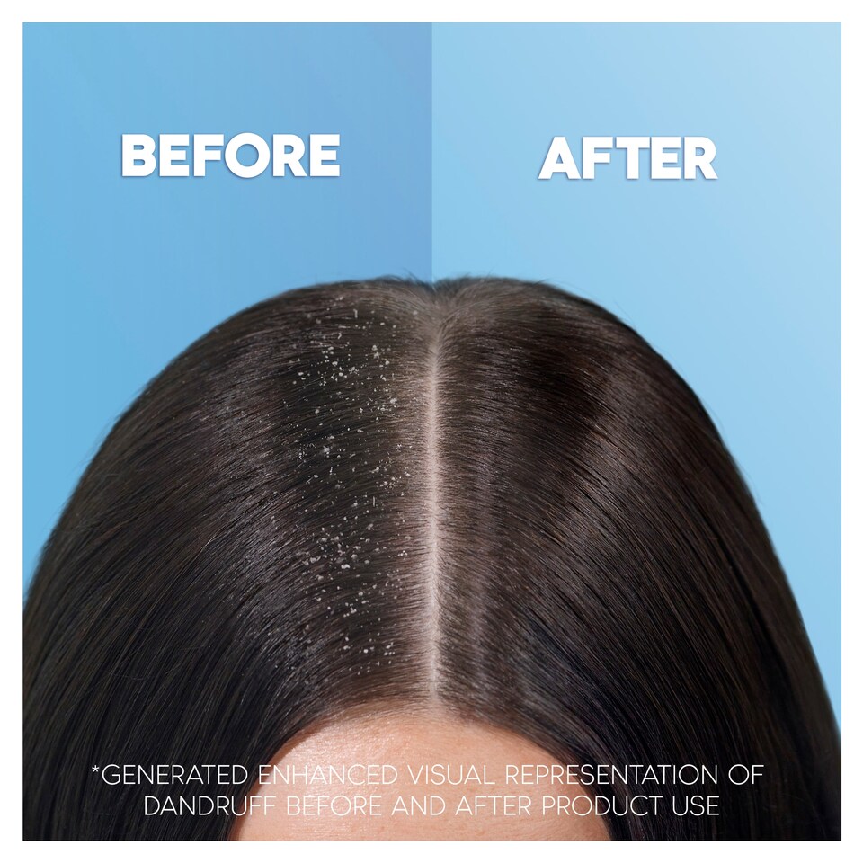 Head & Shoulders Apple Fresh Korpásodás Elleni Sampon, 900 ml  1. kép