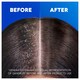 image 4 of Head & Shoulders Supreme Repair Anti Dandruff Shampoo 400ml