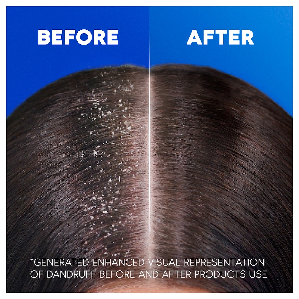 image 1 of Head & Shoulders Supreme Repair Anti Dandruff Shampoo 400ml