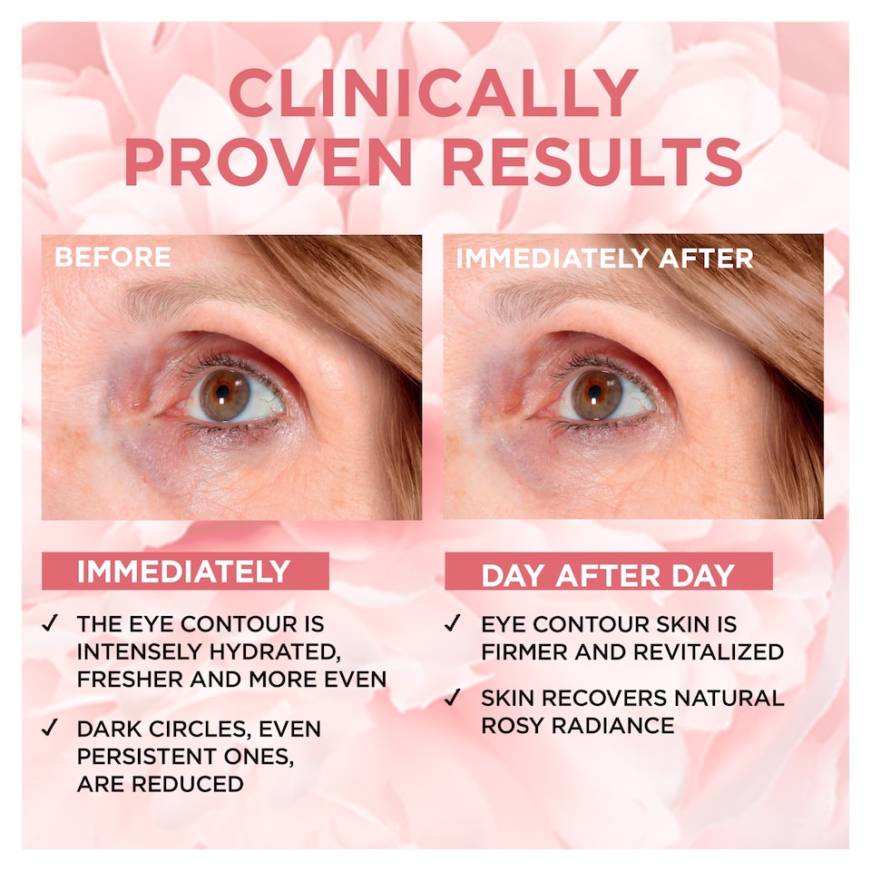 image 1 of L'Oreal Paris Age Perfect Golden Age Rosy Glow Eye Cream for Dark Circles 15Ml