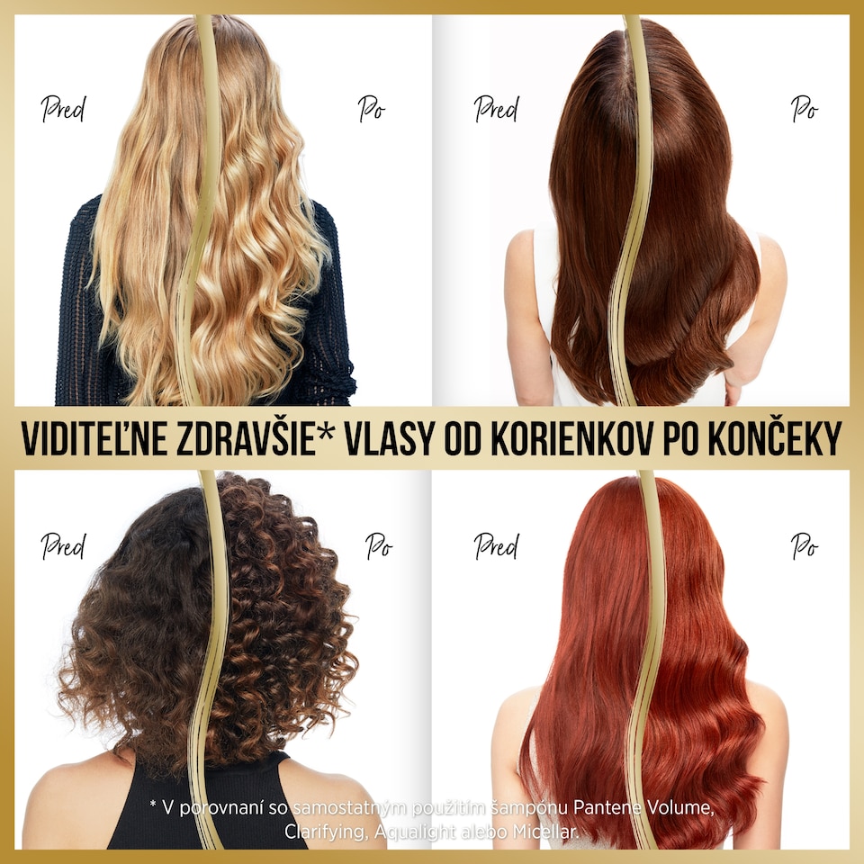 obrázok 1 z Pantene Pro-V Posilňujúce Sérum, Infinitely Long | Na Stredne Dlhé Až Dlhé Poškodené Vlasy | 200 ml