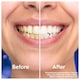 image 3 of Oral-B 3D White Clinical Intensive Whitening Radiant White 75ml