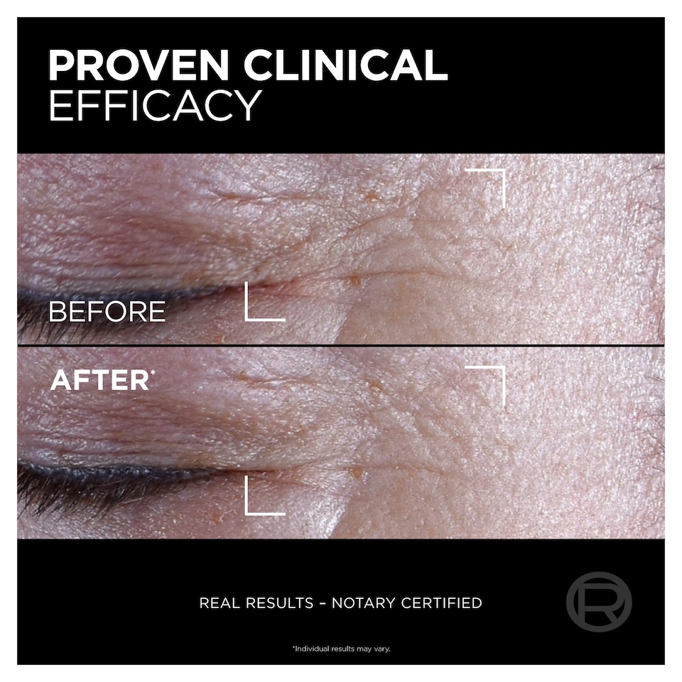 image 1 of L'Oreal Paris Age Perfect Cell Renew Midnight Eye Cream 15ml