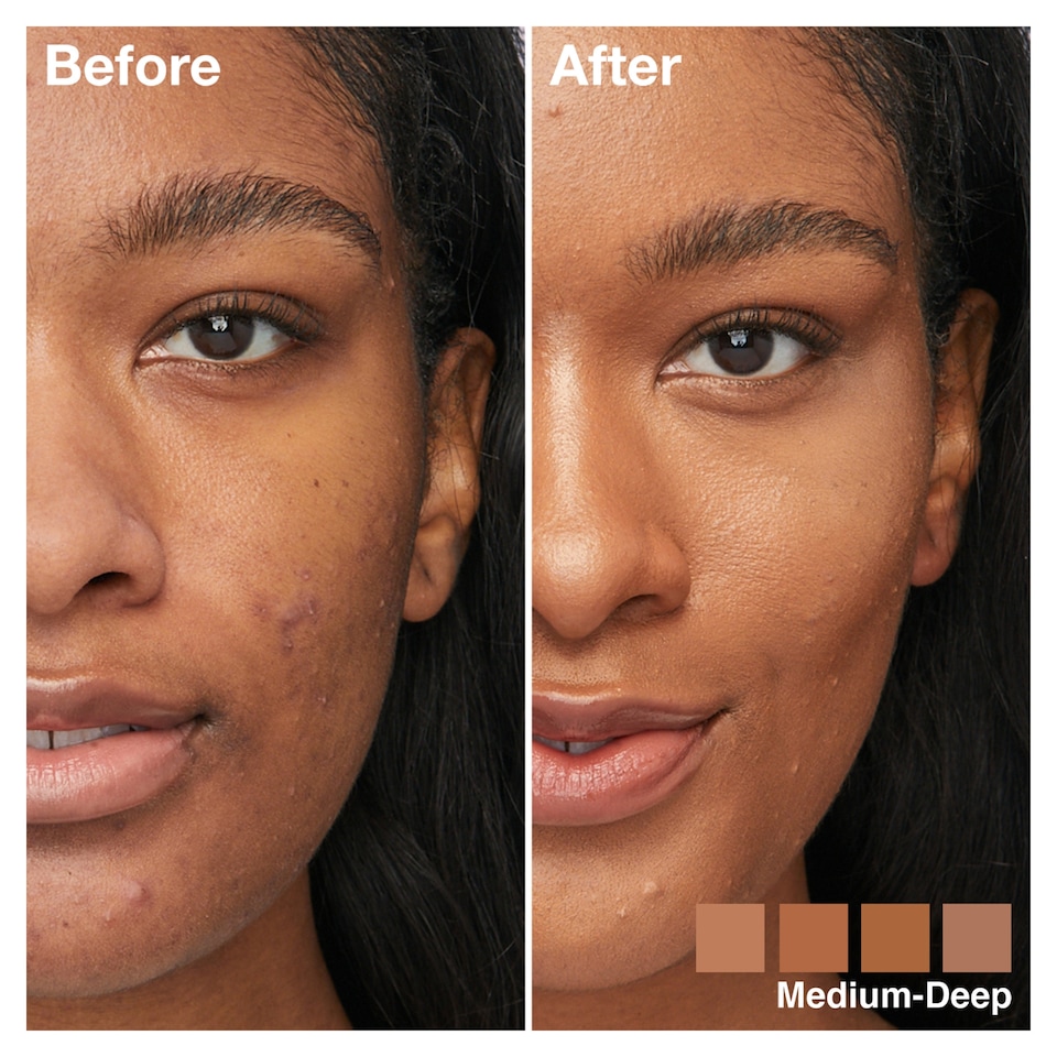 image 1 of Maybelline Instant Anti- Age Perfector 4-In- 1 Medium Deep 20Ml