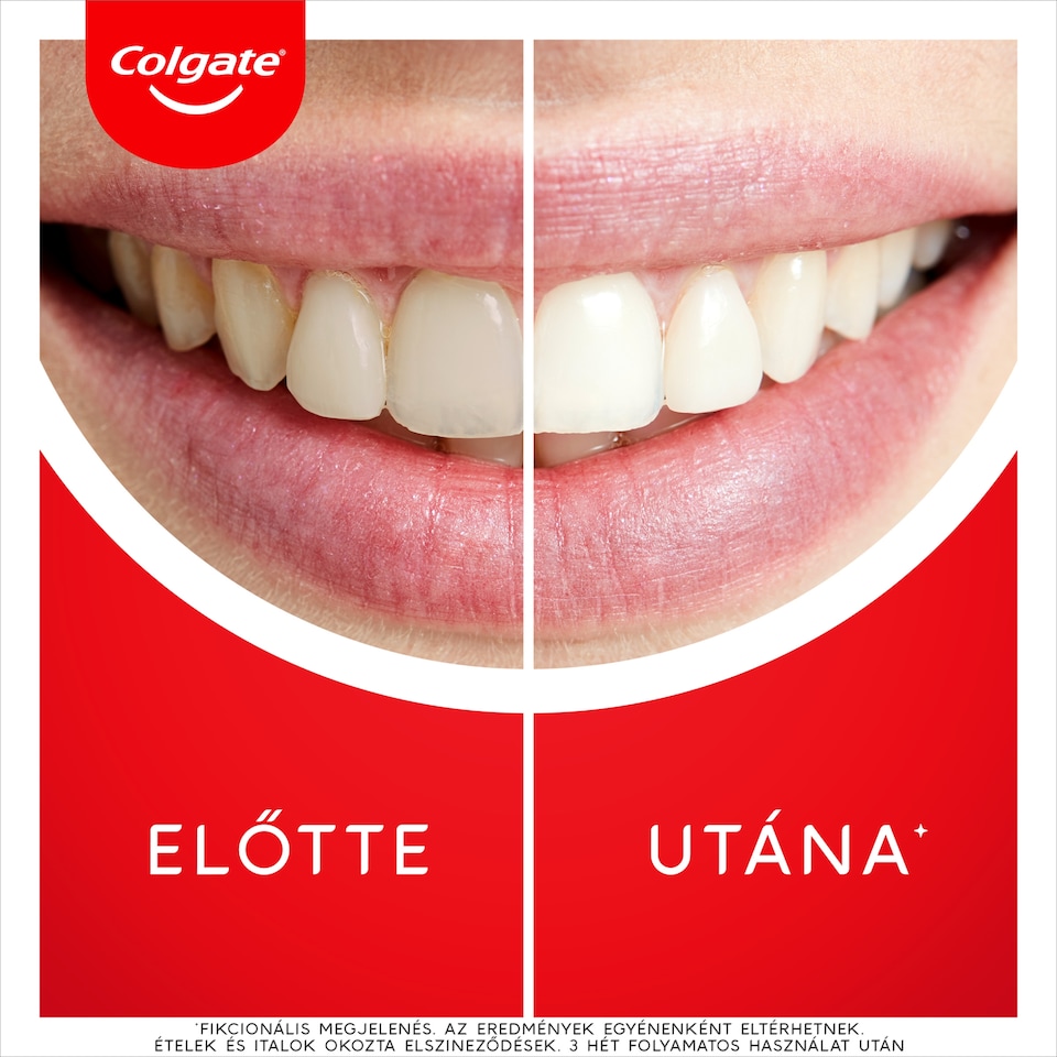Colgate Max White Ultra Freshness Pearls fogfehérítő fogkrém 50 ml  1. kép