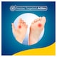 image 3 of Scholl Verruca and Wart Freeze Remover Kit 80 Ml