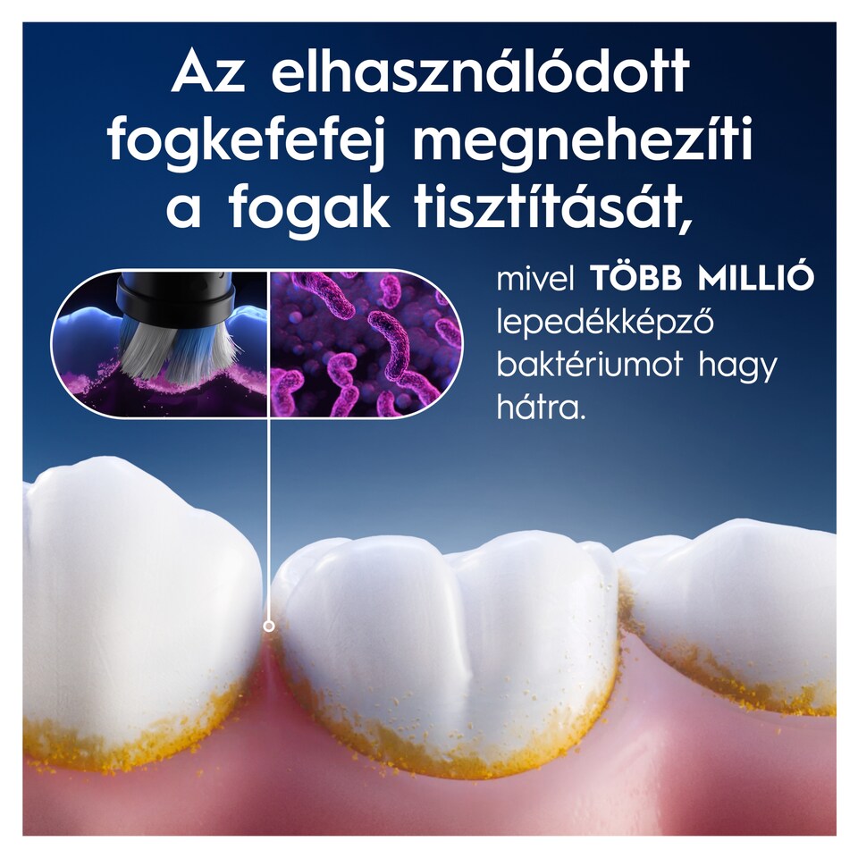 Oral-B iO Series Gentle Care, Eredeti Fogkefefej, Érzékeny Fogínyhez, 4 1. kép