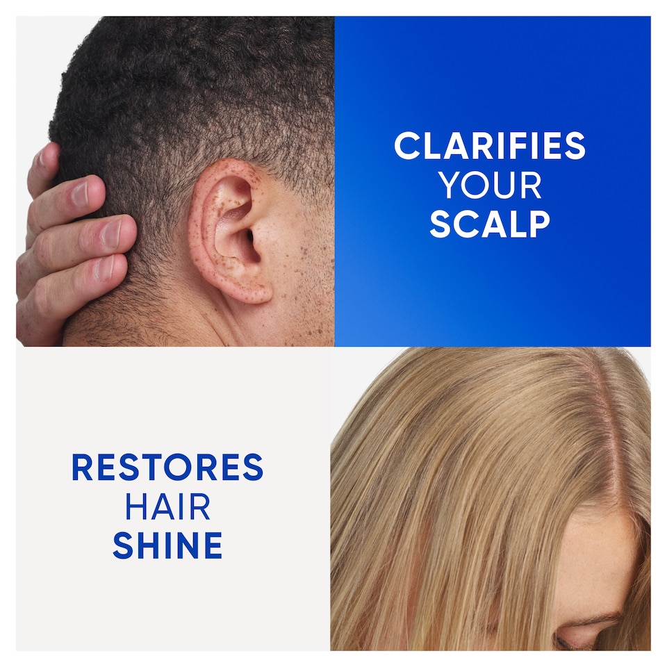 image 1 of Head & Shoulders Clarify & Shine With Apple Cider Vinegar Shampoo 400ML