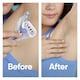 image 4 of Gillette Venus Deluxe Smooth Swirl Women's Razor Blades 3  Pack