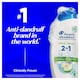 image 2 of Head & Shoulders Apple Fresh 2in1 330ml