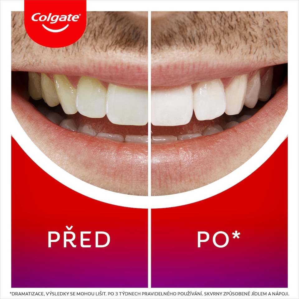 Obrázek 1 pro produkt Colgate Max White Overnight noční bělicí sérum 2.5ml