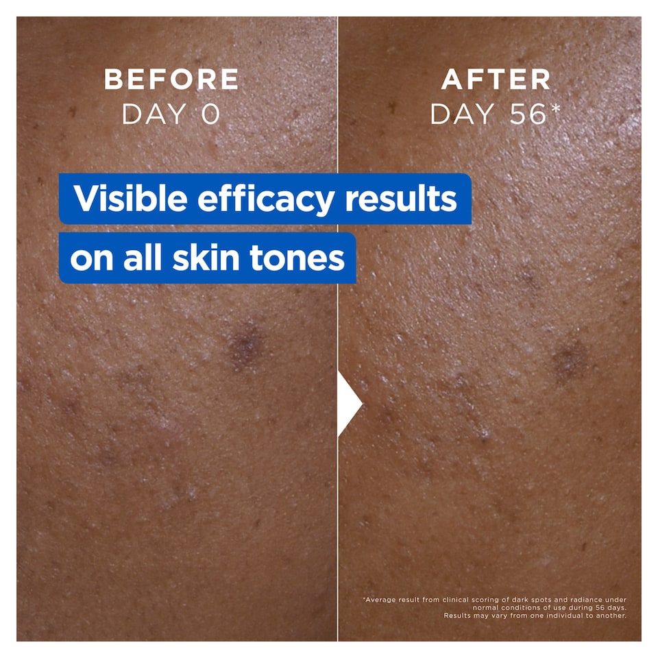 image 1 of Mixa Body Niacinamide Bright Cream Jar 400ml