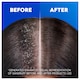 image 4 of Head & Shoulders Sensitive Scalp Anti Dandruff Shampoo 400Ml