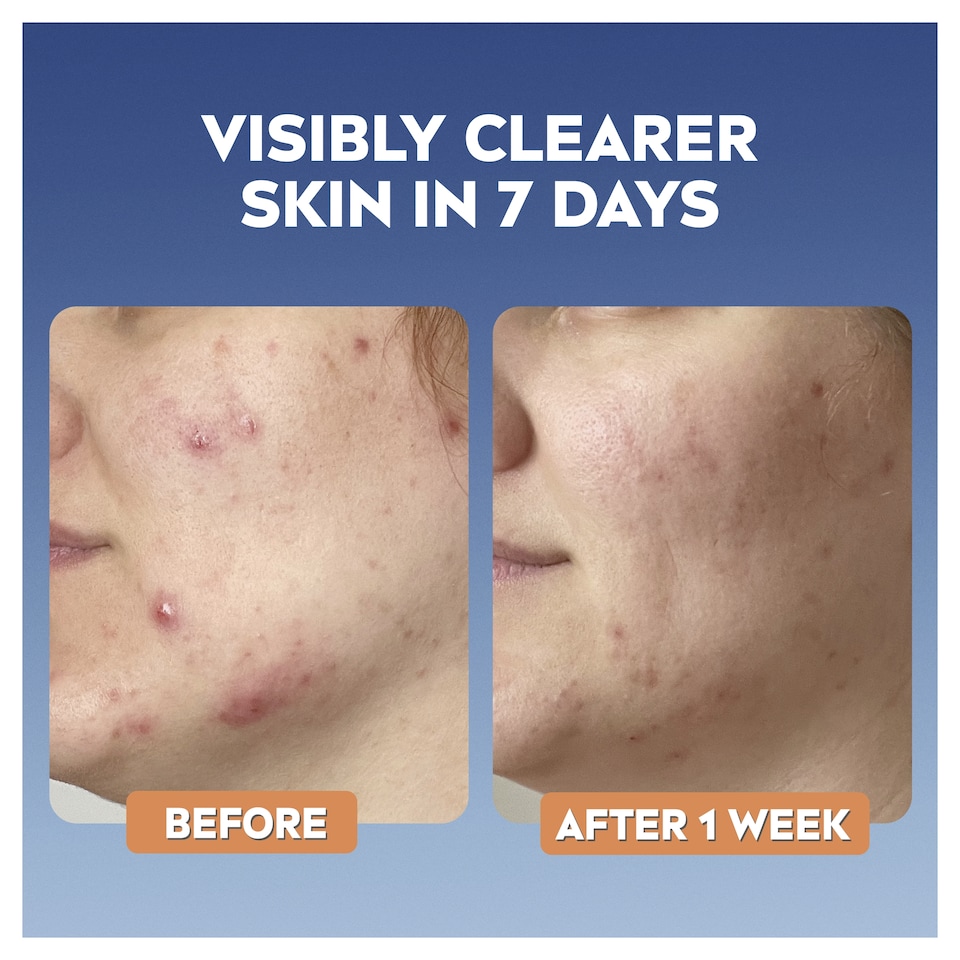 image 1 of NIVEA Derma Skin Clear Toner 200ml