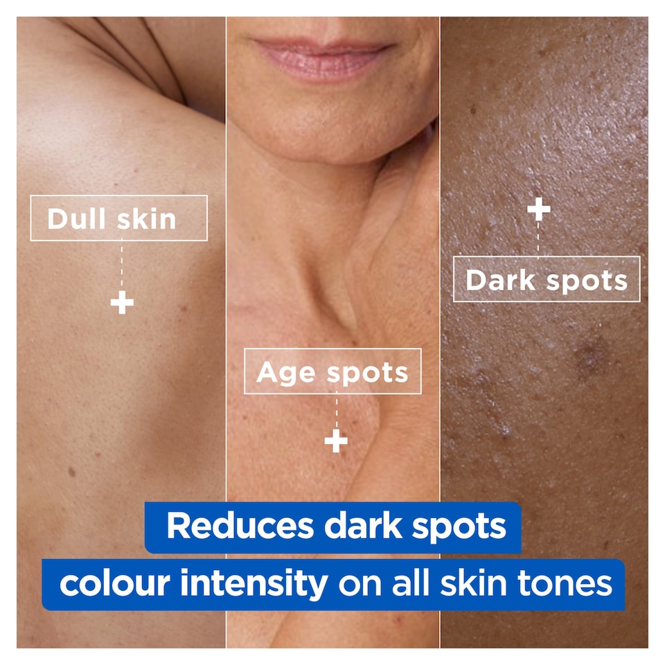 image 1 of Mixa Body Niacinamide Bright Cream Jar 400ml