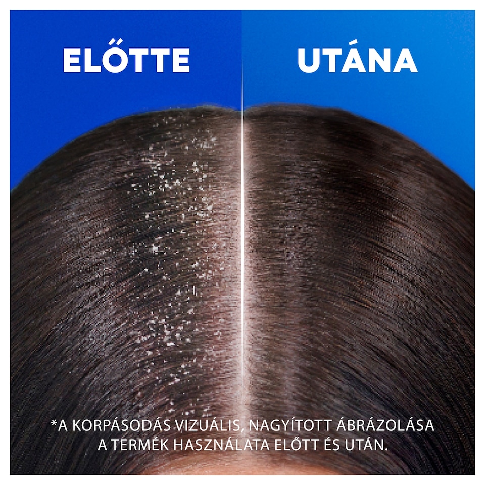 Head & Shoulders Citrus Fresh korpásodás elleni sampon zsíros hajra 500ml napi használatra 1. kép