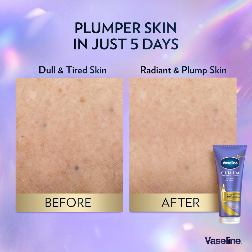 image 1 of Vaseline Gluta-Hya Overnight Radiance Body Lotion Moisturiser 200ml