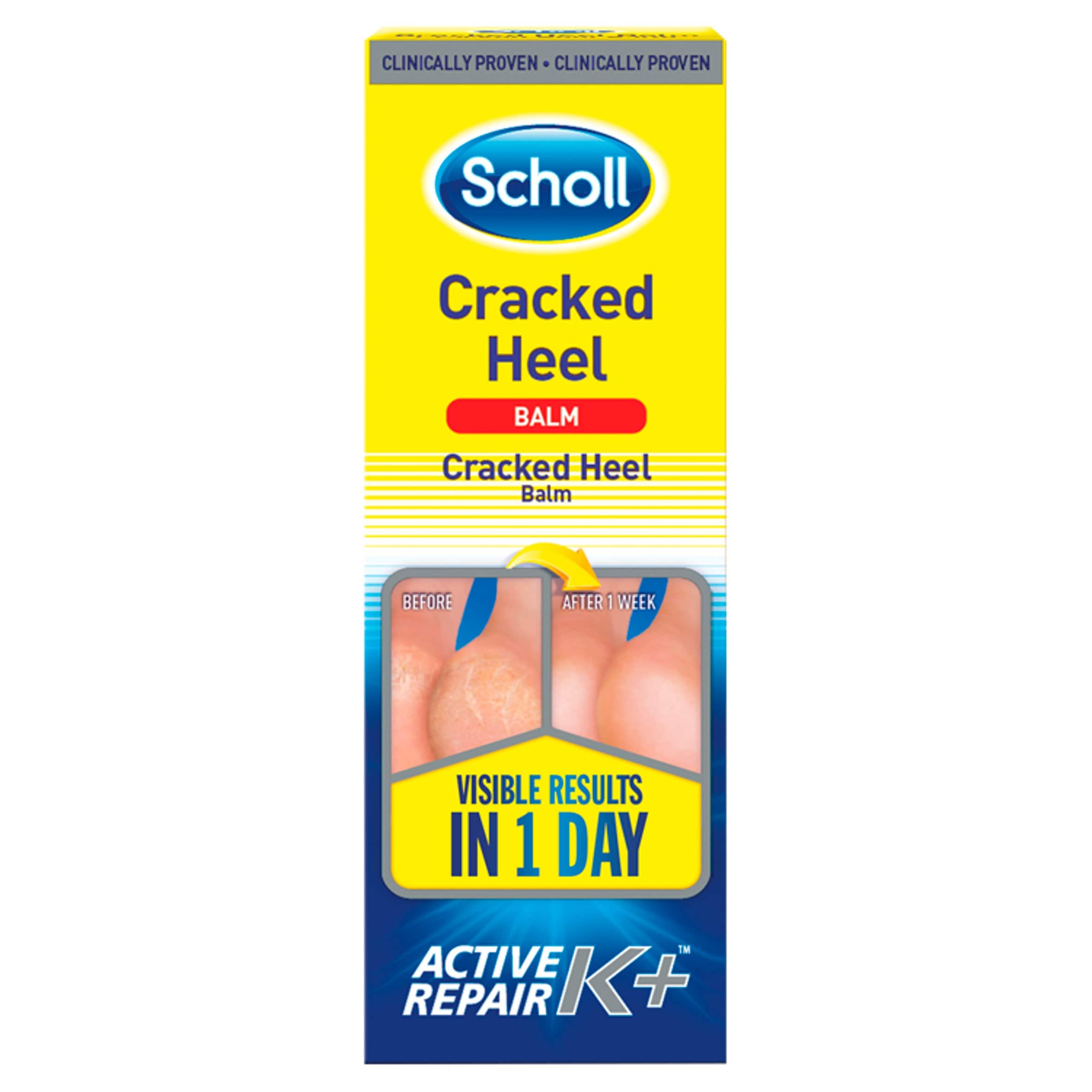 scholl cracked heel balm