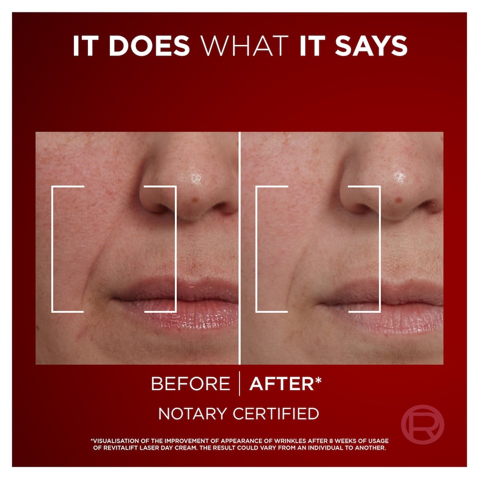image 1 of L'Oreal Paris Revitalift Laser Renew Cream 50Ml