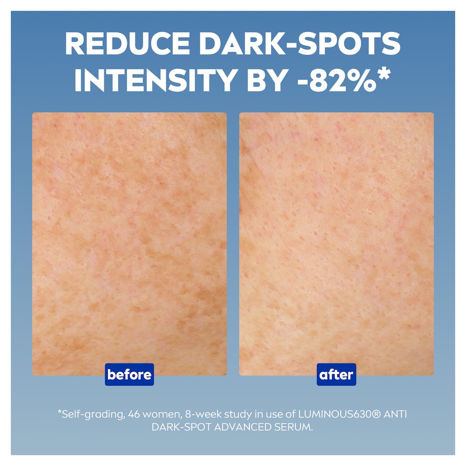 image 1 of NIVEA Luminous 630 Anti Dark Spot Face Serum 30ml