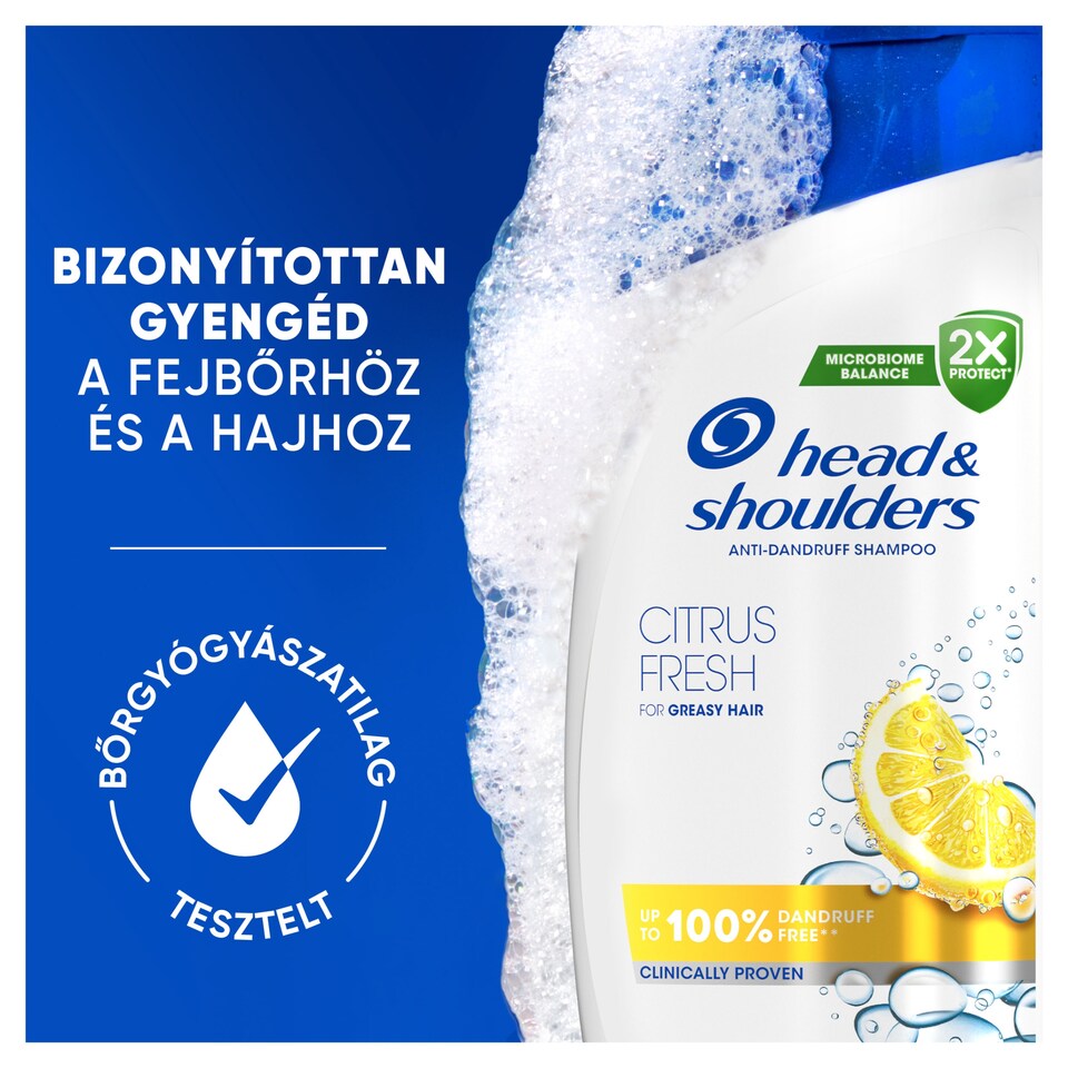 Head & Shoulders Citrus Fresh korpásodás elleni sampon zsíros hajra 500ml napi használatra 1. kép
