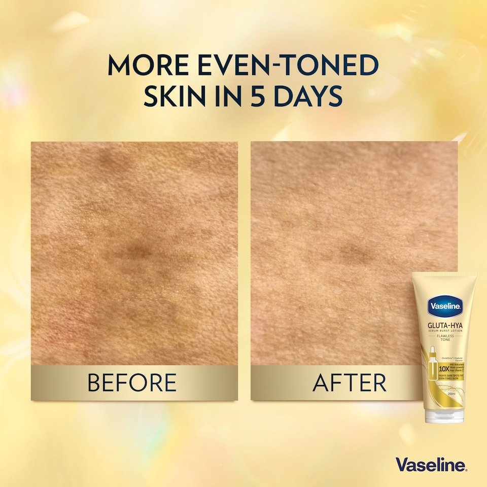 image 1 of Vaseline Gluta-Hya Flawless Tone Body lotion Moisturiser 200ml