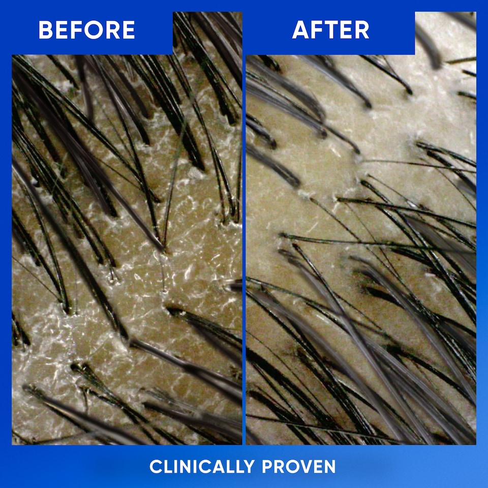 image 1 of Head & Shoulders Clarify & Shine With Apple Cider Vinegar Shampoo 400ML