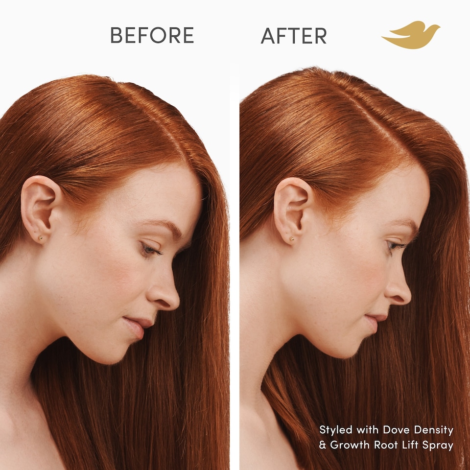 image 1 of Dove Scalp Hair Therapy Density & Growth Root Lift Spray 100ml
