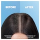 image 3 of Head & Shoulders 2 In 1 Itchy Scalp Shampoo Conditioner 450Ml